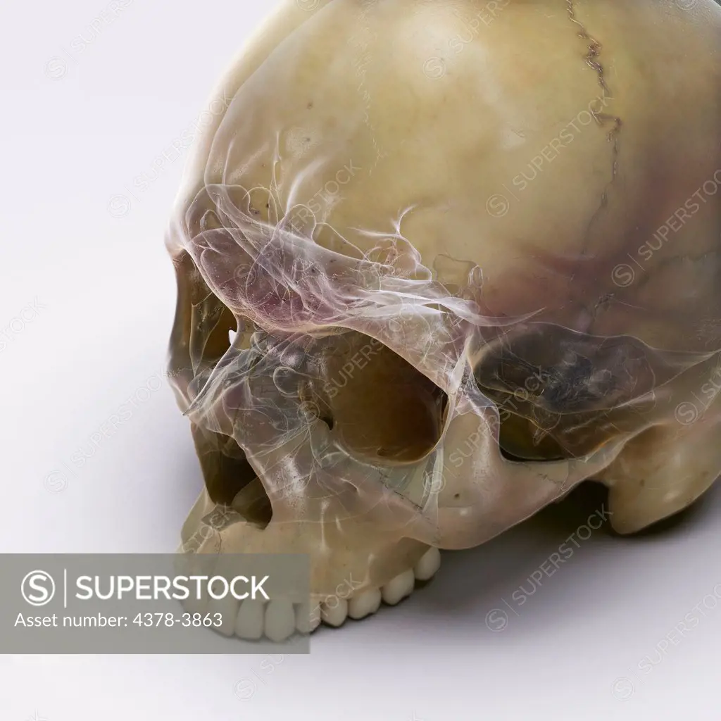 A human skull without the lower jaw on a white surface. The inner structures of the skull are visible with an X-ray appearance.