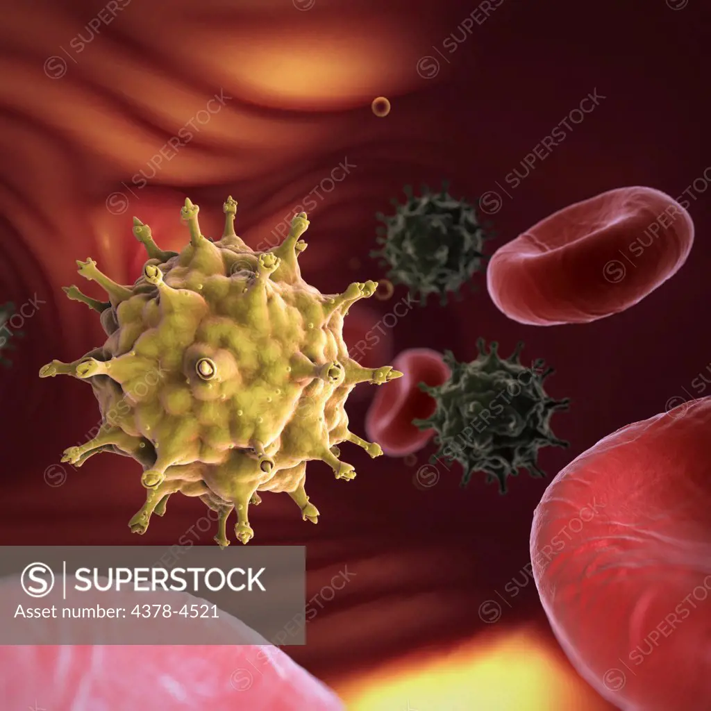 HIV Infection