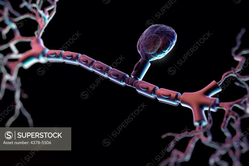 Unipolar Neuron