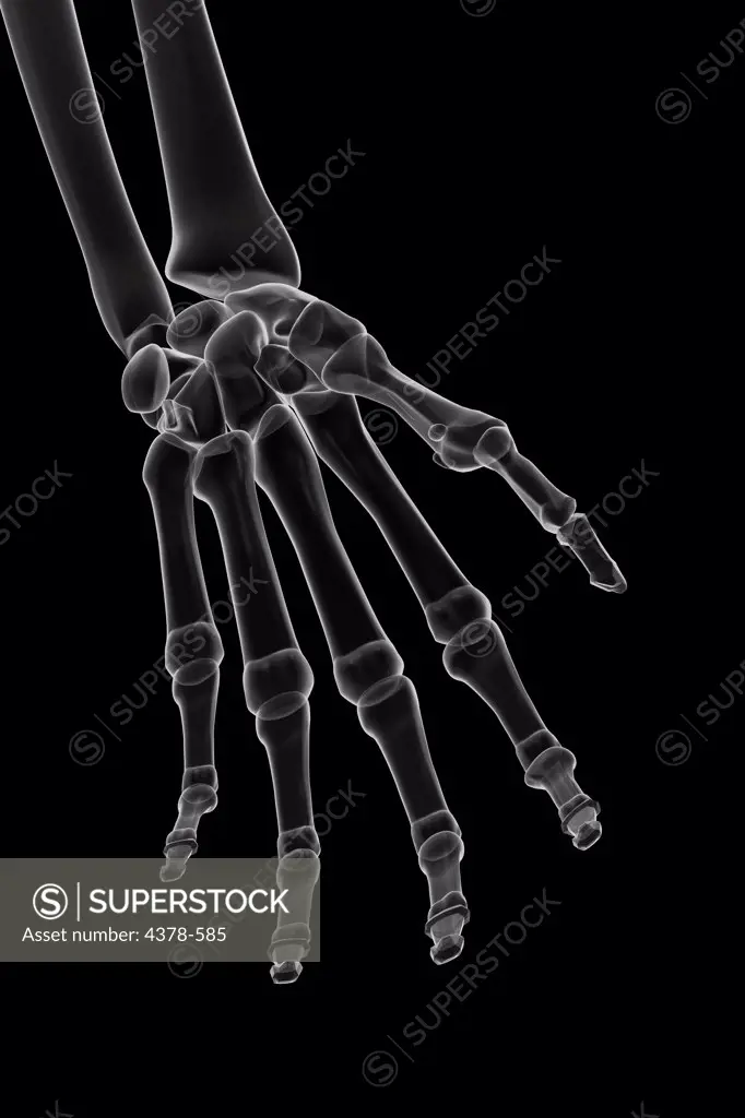 X-ray stylized bones of the left hand and wrist.