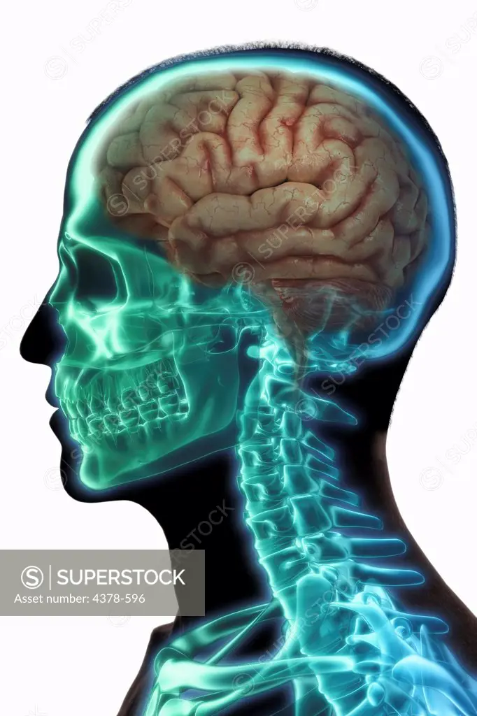 Silhouette of male head with brain and skeleton visible.