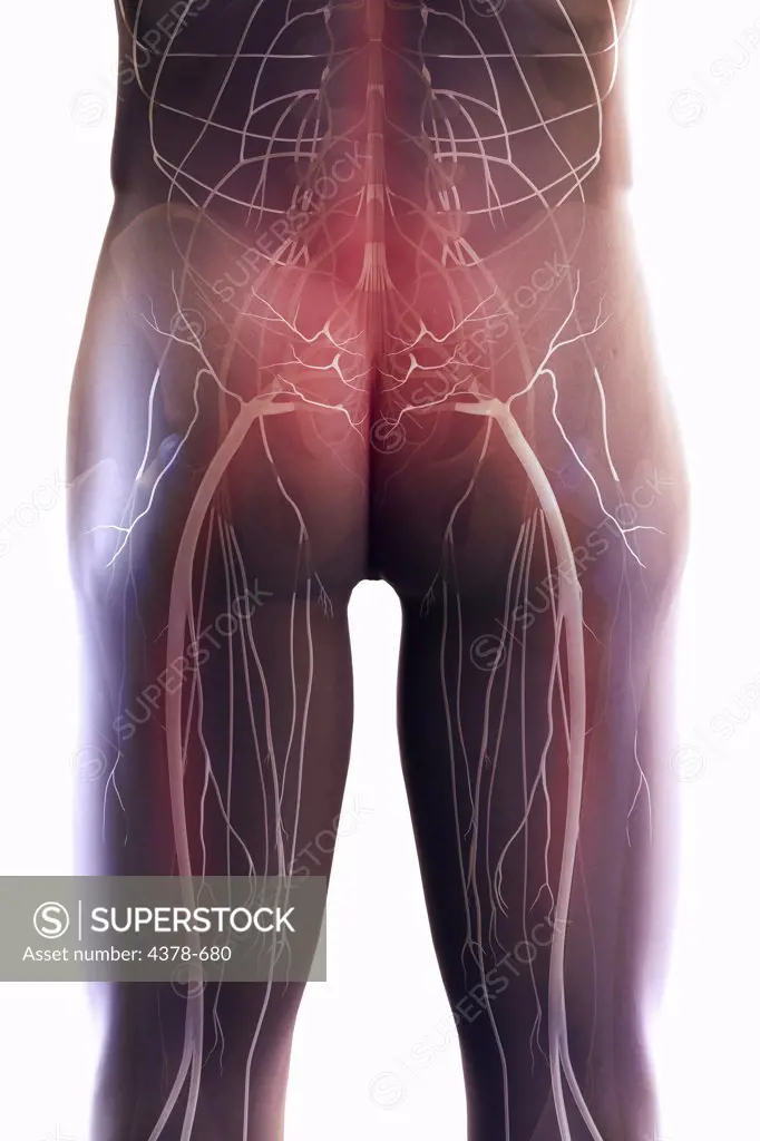 Rear view of the nerves and bones of the lower back and upper legs. The red highlight represents sciatic pain.
