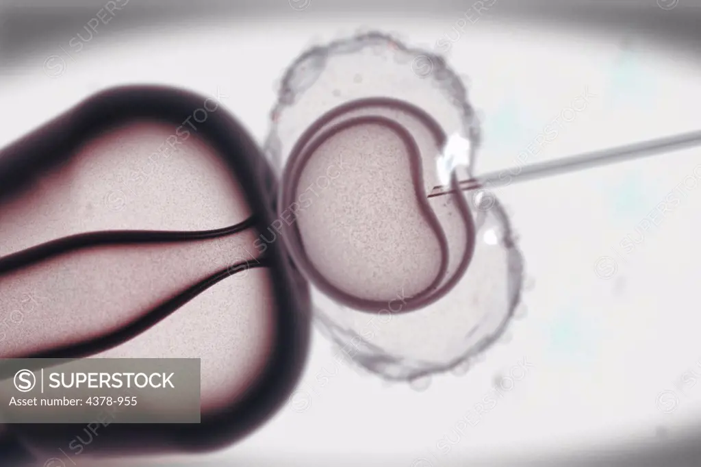 Stylized visualization of in vitro fertilization.