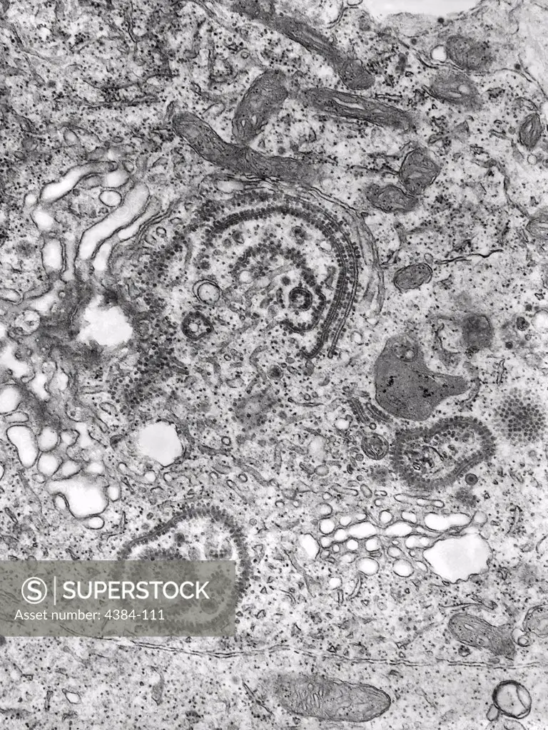 This transmission electron micrograph (TEM) revealed the presence of a number of Eastern Equine Encephalitis (EEE) virus virions that happened to be in a specimen of central nervous system tissue. EEE is a zoonotic arbovirus, which means that its spead to human beings through the bite of an infected mosquito. EEE virus (EEEV) occurs in the eastern half of the United States where it causes disease in humans, horses, and some bird species. Because of the high mortality rate, EEE is regarded as on
