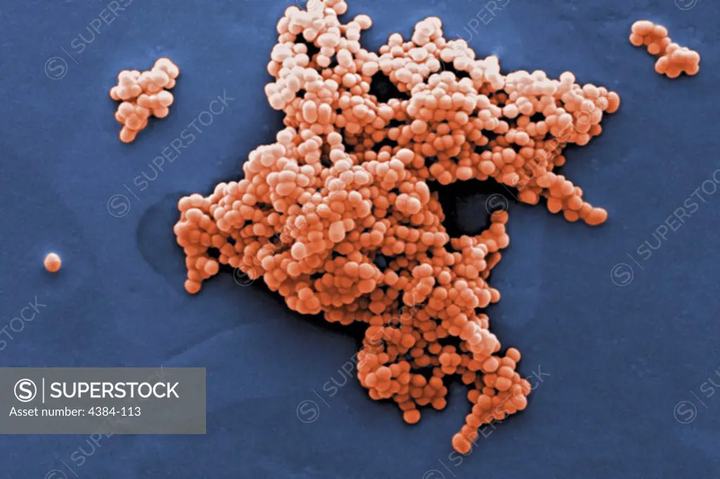 Under a moderate magnification of 2,969X, this scanning electron micrograph (SEM) revealed a number of clusters of Gram-positive, beta-hemolytic Group C Streptococcus sp.  bacteria. The genus Streptococcus is comprised of microaerophilic cocci (round), which are not motile and occur in chains or pairs. The genus is defined by a combination of antigenic, hemolytic, and physiological characteristics into Groups A, B, C, D, F, and G. Groups A and D can be transmitted to humans via food. Photo by Ja