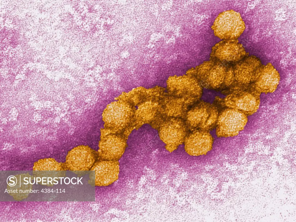 An electron micrograph of the West Nile virus. West Nile virus is a flavivirus commonly found in Africa, West Asia, and the Middle East. It is closely related to St. Louis encephalitis virus found in the United States. The virus can infect humans, birds, mosquitoes, horses and some other mammals. Photo by Cynthia Goldsmith.