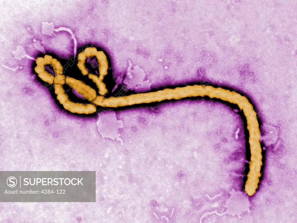 This colorized transmission electron micrograph (TEM) revealed some of the ultrastructural morphology displayed by an Ebola virus virion. Ebola hemorrhagic fever (Ebola HF) is a severe, often-fatal disease in humans and nonhuman primates (monkeys, gorillas, and chimpanzees) that has appeared sporadically since its initial recognition in 1976. The disease is caused by infection with Ebola virus, named after a river in the Democratic Republic of the Congo (formerly Zaire) in Africa, where it was f