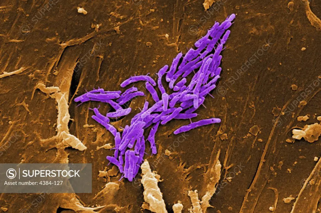 Under a magnification of 3841X, this scanning electron micrograph (SEM) revealed some of the ultrastructural morphologic details exhibited by a number of Gram-positive bacilli, or rod-shaped,  Mycobacterium fortuitum bacteria. M. fortuitum is classified as a rapidly-growing Mycobacterium, due to the fact that it can be grown on laboratory culture medium in less than 7 days.  As a human pathogen, this organism has been determined to be the cause of skin infections, including furunculosis, i.e