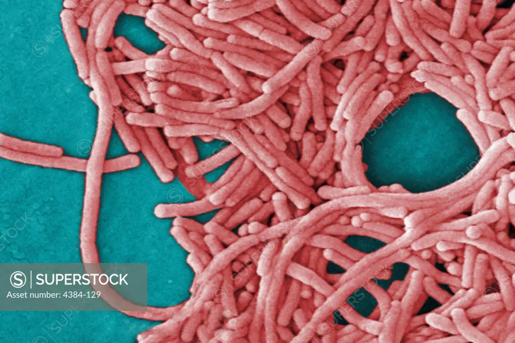 Under a moderately-high magnification of 8000X, this colorized scanning electron micrograph (SEM) depicted a large grouping of Gram-negative Legionella pneumophila bacteria. Of particular importance is the presence of polar flagella, and pili, or long streamers, which due to their fragile nature, in some of these views seem to be dissociated from any of the bacteria. Note that a number of these bacteria seem to display an elongated-rod morphology.  L. pneumophila  are known to most frequently ex