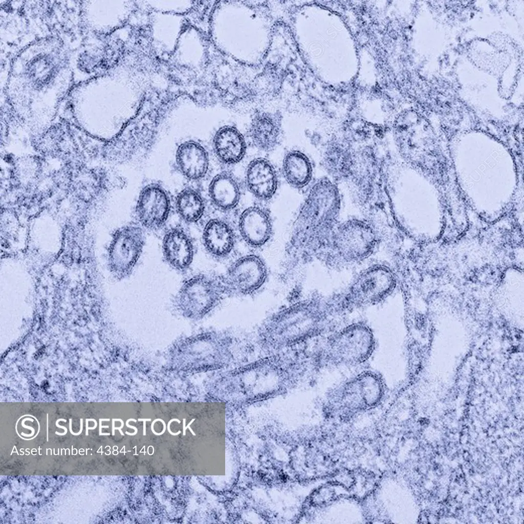 This colorized transmission electron micrograph (TEM) revealed the presence of a number of Novel H1N1 virus virions in this tissue sample. Novel H1N1 (referred to as swine flu early on) is a new influenza virus causing illness in people. This new virus was first detected in people in the United States in April 2009. This virus is spreading from person-to-person worldwide, probably in much the same way that regular seasonal influenza viruses spread. On June 11, 2009, the World Health Organizati