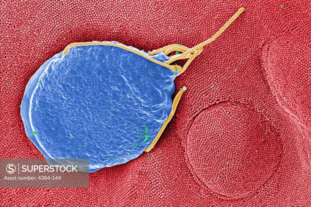 This digitally-colorized scanning electron micrograph (SEM) depicted a Giardia muris protozoan adhering itself to the microvillous border of an intestinal epithelial cell.  Each small circular profile under the protozoan represents the rounded tip of a single microvillous, and it is estimated that 2000 to 3000 microvilli cover the surface of a single intestinal epithelial cell.  The two circular lesions on the right side of the photograph are impressions made by the ventral adhesive disk of othe
