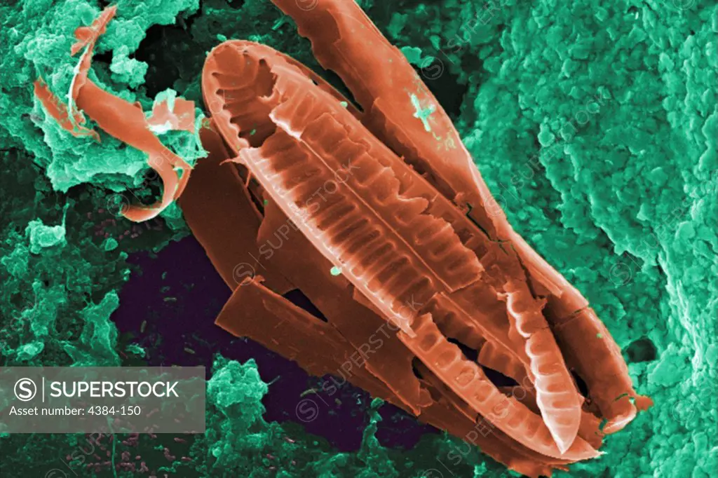 This digitally-colorized scanning electron micrograph (SEM) of an untreated water specimen extracted from a wild stream mainly used to control flooding during inclement weather revealed the presence of unidentified organisms, which included bacteria, protozoa, and algae. In this particular view, it appears that a diatom had been fractured in the processing of this specimen. Surrounding this diatomic microorganism, was a large biofilm mass within, and around which were numerous protozoan amoeboid