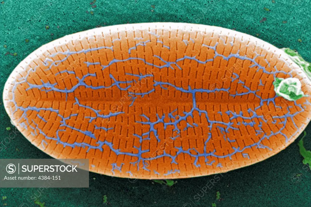 This digitally-colorized scanning electron micrograph (SEM) of an untreated water specimen extracted from a wild stream mainly used to control flooding during inclement weather revealed the presence of unidentified organisms, which included bacteria, protozoa, and algae. In this particular image, a single unidentified diatomic microorganism was depicted revealing a wondrous symmetrical ultrastructural morphology.  Though many organisms found in untreated waters are harmless, there are many that 