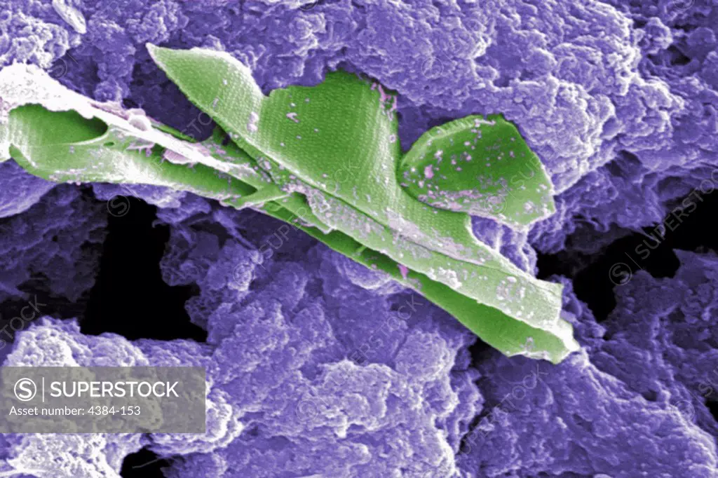 This digitally-colorized scanning electron micrograph (SEM) of an untreated water specimen extracted from a wild stream mainly used to control flooding during inclement weather, revealed the presence of unidentified organisms, which included bacteria, protozoa, and algae. In this particular image, unidentified sheets of algae were wrapped in a mass of what appeared to be a mucoid amorphous biofilm. Though many organisms found in untreated waters are harmless, there are many that are pathogenic t