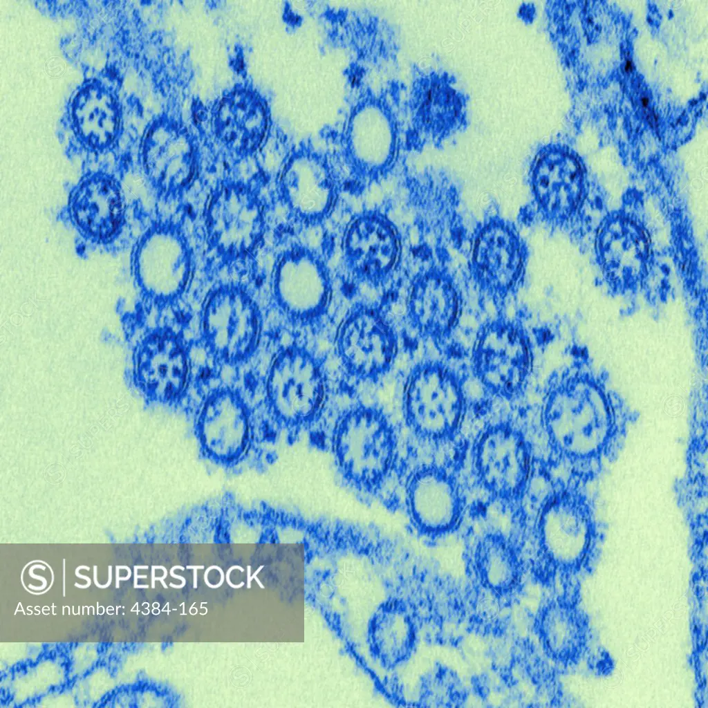 This highly-magnified, digitally-colorized transmission electron micrograph (TEM) depicted numbers of virions from a Novel Flu H1N1 isolate. 2009 H1N1 (sometimes called swine flu) is a new influenza virus causing illness in people. This new virus was first detected in people in the United States in April 2009. This virus is spreading from person-to-person worldwide, probably in much the same way that regular seasonal influenza viruses spread. On June 11, 2009, the World Health Organization (WH