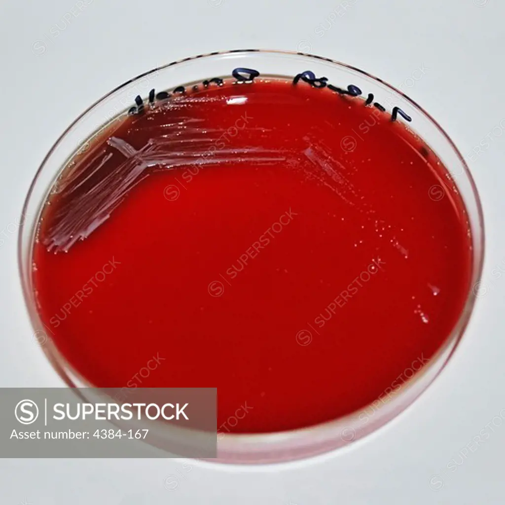 Colonies of Brucella abortus bacteria, which have been cultivated on sheeps blood agar (SBA), for a period of 48 hours. This bacteria is the cause of brucellosis in livestock. Brucella species are facultative, intracellular, gram-negative coccobacilli. Nine species of Brucella are currently defined by phenotypic and antigenic differences, in addition to differential host specificity. Known human pathogens: B. abortus, B. melitensis, B. suis, and B. canis. Eating or drinking contaminated milk pr