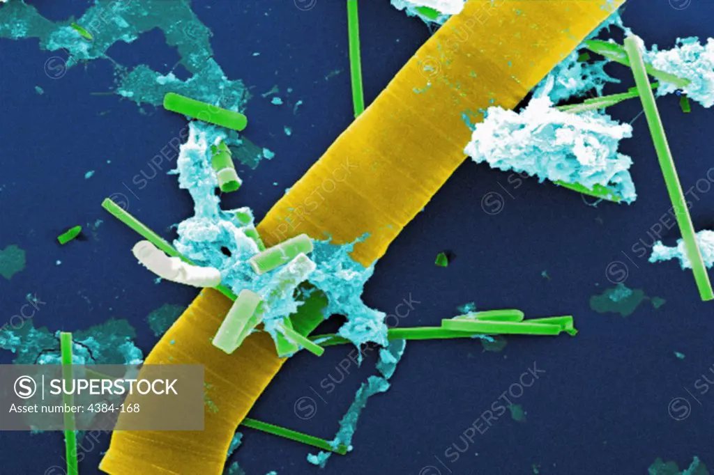 Under a relatively low magnification of 200X, this digitally-colorized scanning electron micrograph (SEM) of an untreated water specimen extracted from a wild stream mainly used to control flooding during inclement weather, revealed the presence of unidentified organisms, which included bacteria, protozoa, and algae. In this particular view, number of what appeared to be rod-shaped sections of various sizes were scattered throughout the field of view, which though unconfirmed, may have been vege