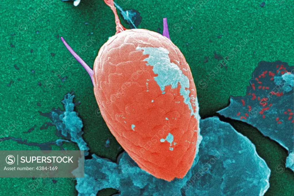 Under a moderate magnification of 1000X, this digitally-colorized scanning electron micrograph (SEM) of an untreated water specimen extracted from a wild stream mainly used to control flooding during inclement weather, revealed the presence of unidentified organisms, which included bacteria, protozoa, and algae. In this particular view, a single copepod-like microorganism was seen occupying the field of view, which seemed to be encased in an outer shell of armour-like plates, or scales. Looking 
