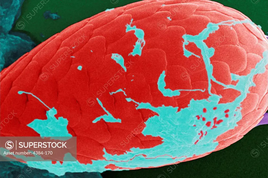 Under a moderate magnification of 2000X, this digitally-colorized scanning electron micrograph (SEM) of an untreated water specimen extracted from a wild stream mainly used to control flooding during inclement weather, revealed the presence of unidentified organisms, which included bacteria, protozoa, and algae. In this particular view, a single copepod-like microorganism was seen occupying the field of view, which seemed to be encased in an outer shell of armour-like plates, or scales. Looking 
