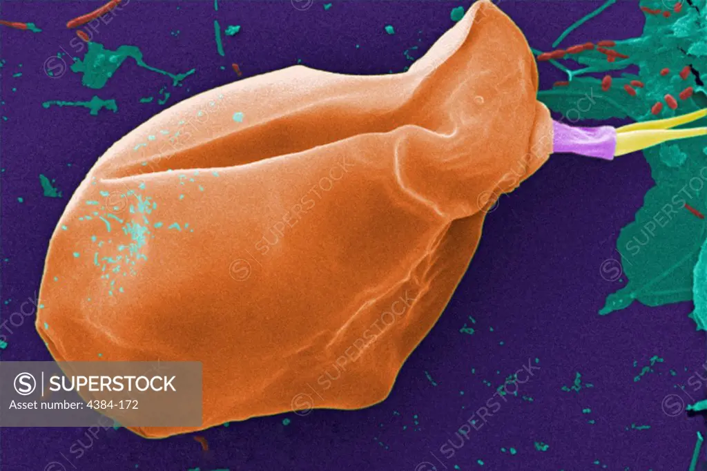 Under a moderate magnification of 2000X, this digitally-colorized scanning electron micrograph (SEM) of an untreated water specimen extracted from a wild stream mainly used to control flooding during inclement weather, revealed the presence of unidentified organisms, which included bacteria, protozoa, and algae. In this particular view, a single copepod-like microorganism was seen occupying the field of view, which seemed to be encased in an outer shell of armour-like plates, or scales. Looking 
