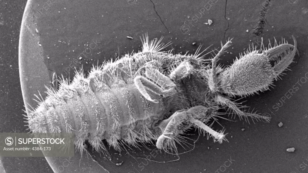 Under a very low magnification of 13X, this scanning electron micrograph depicted the entire ventral surface of the larval staged antlion, sometime referred to as a doodlebugs, because of the trails they leave in the soft sand as they hunt for prey.  These arthropods undergo dramatic morphologic changes when it metamorphoses into a beautiful flying antlion lacewing. Note the large mandibles to the right, which are used to apprehend prey that unwittingly fall into the conical sand trap construc