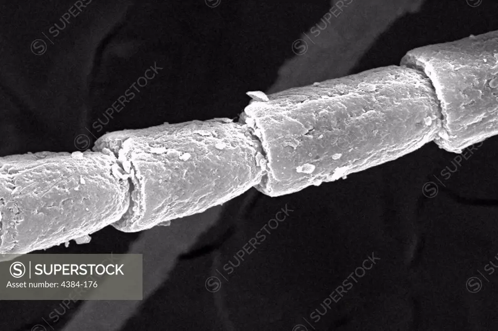 Under a moderately-high magnification of 1244x this scanning electron micrograph (SEM) depicted some of the ultrastructural details displayed on the antennal flagellum emanating from the head region of a larval antlion. This larva is sometimes referred to as a doodlebug, because of the trails it leaves in the soft sand as it hunts for prey.  This arthropod undergoes dramatic morphologic changes when it metamorphoses into a beautiful flying antlion lacewing. The antenna is composed of three mai