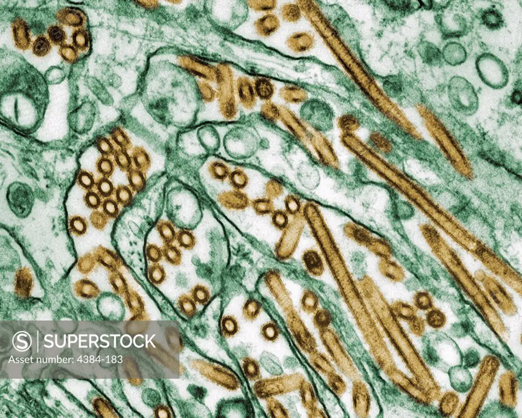 Colorized transmission electron micrograph of Avian influenza A H5N1 viruses (seen in gold) grown in MDCK cells (seen in green). Photo by Cynthia Goldsmith