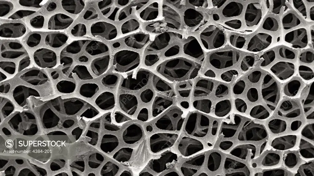 Under a low magnification of 38x, this 2007 scanning electron micrograph (SEM) shows the fibrous configuration of a dry macrofoam sponge swabs. This swab, was scanned for a CDC study involving their efficiency in recovery of Bacillus anthracis bacterial spores from steel coupons that had been inoculated with a spore suspension of known concentration. Results indicated that premoistened swabs were more efficient at recovering spores than dry swabs. Photo by Janice Carr