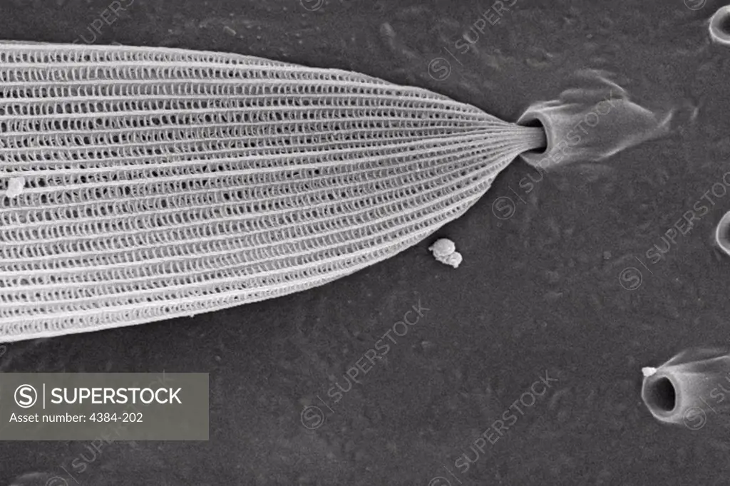 In this relatively highly magnified scanning electron micrographic (SEM) view, some of the wondrous ultrastructural shapes found on the surface of an unidentified white moth were revealed. At this level of magnification, 1479X, the proximal strut of a single scale could be seen as it inserted into its exoskeletal pore. Imagery such as this brings to life the incredible beauty, which goes unseen, but is abundant all around us. Composed of a substance known as chitin, this molecule is made up of b