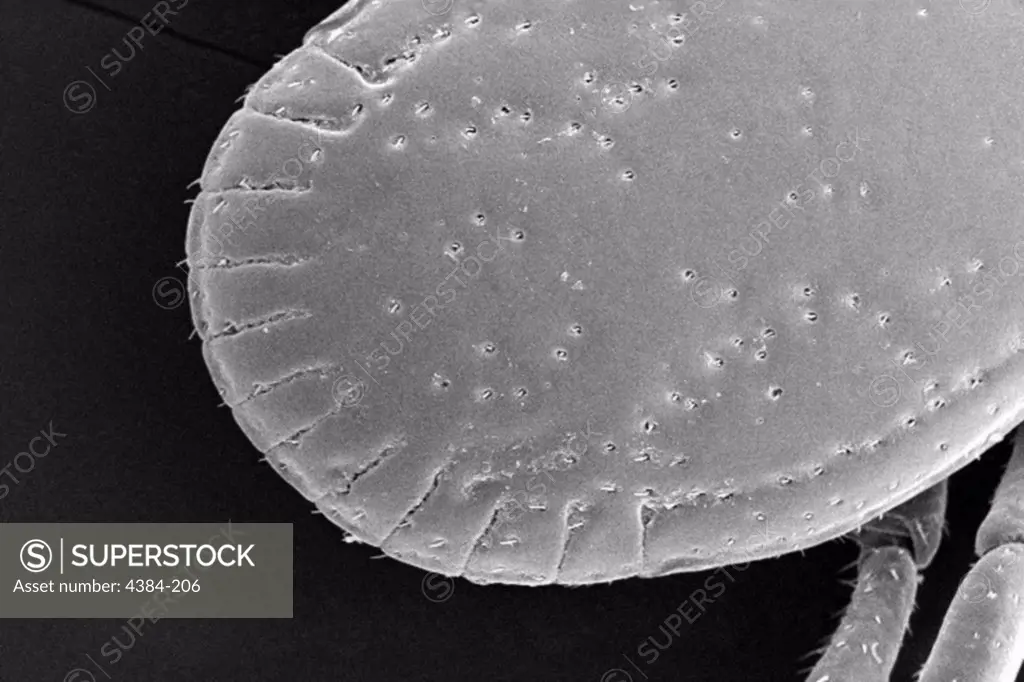 Under a low magnification of 49X, this scanning electron micrograph (SEM) depicted a dorsal view of an unidentified male  tick (Dermacentor  sp.) found upon a cat in the suburbs of Decatur, Georgia, which measured approximately 3.5mm from its mandibulae to the distal abdominal margin. Note that the entire dorsum of this ticks abdomen is covered by its tough scutum, or shield, categorizing it as a male, whereas, in female Ixodid-species ticks, the scutum only partially covers the dorsal abdo