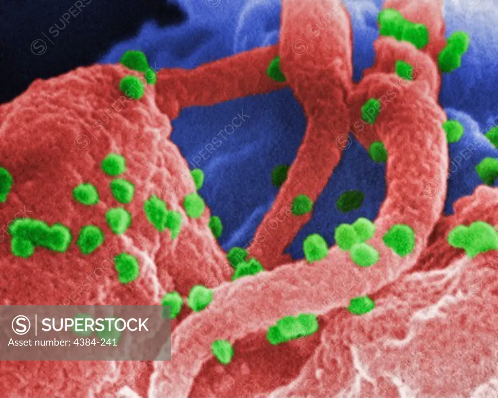Scanning Electron Micrograph of HIV Virions
