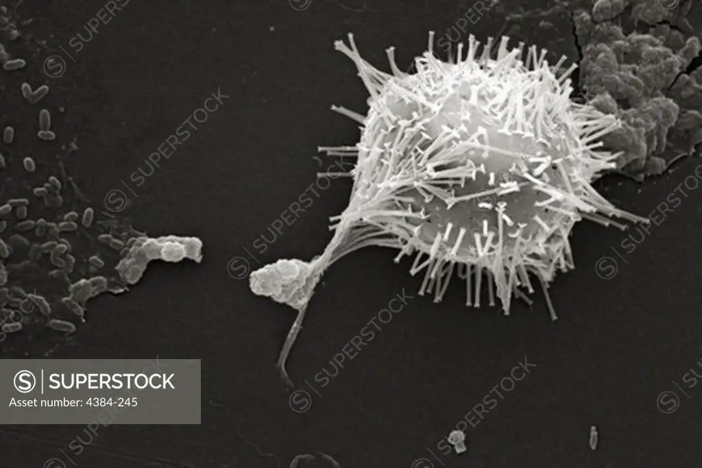 Scanning Electron Micrograph of Untreated Water Sample