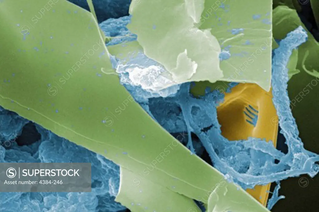 Scanning Electron Micrograph of Untreated Water Sample