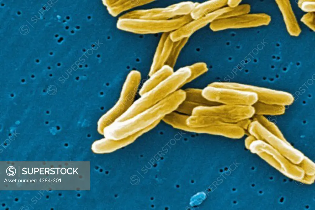 Mycobacterium tuberculosis Bacteria