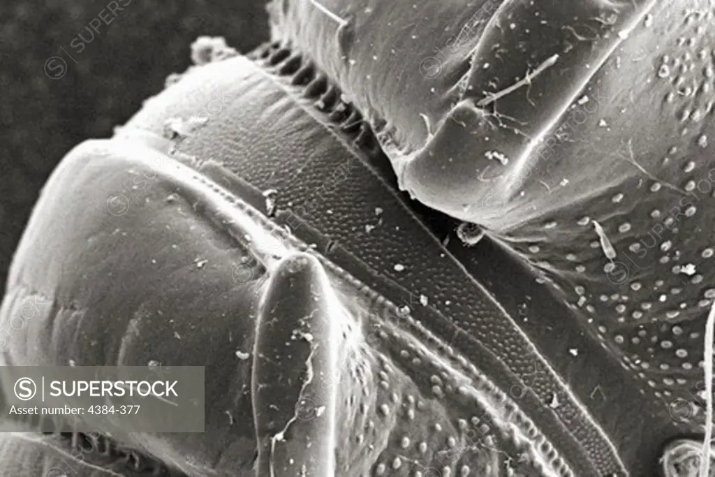 Microscopic Detail of a Millipede