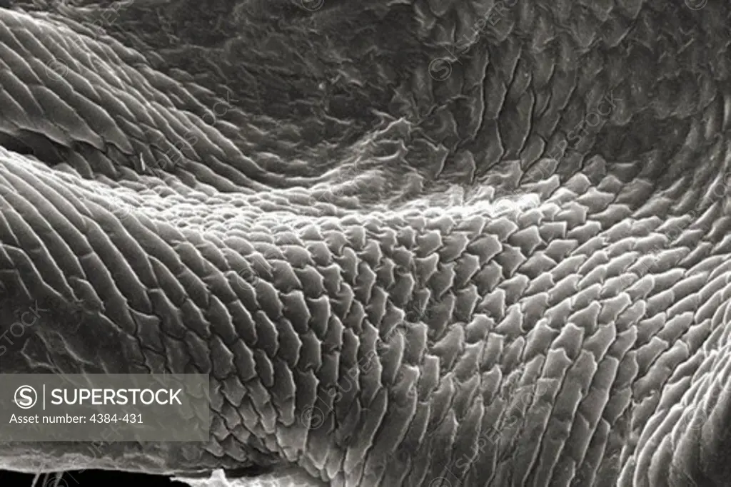 Microscopic Detail of Body Louse's Leg Joint