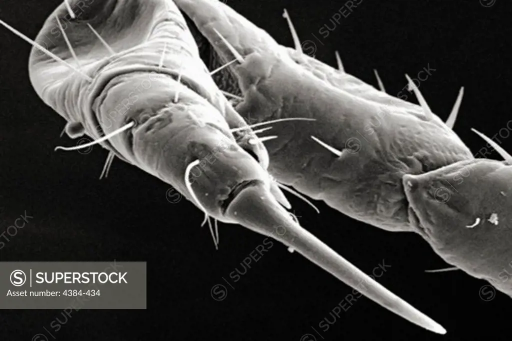 Microscopic Detail of Female Body Louse's Foreleg