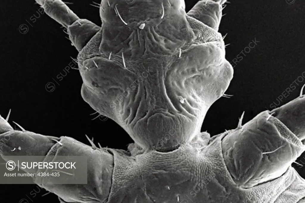 Microscopic Detail of Female Body Louse's Exoskeletal Surface
