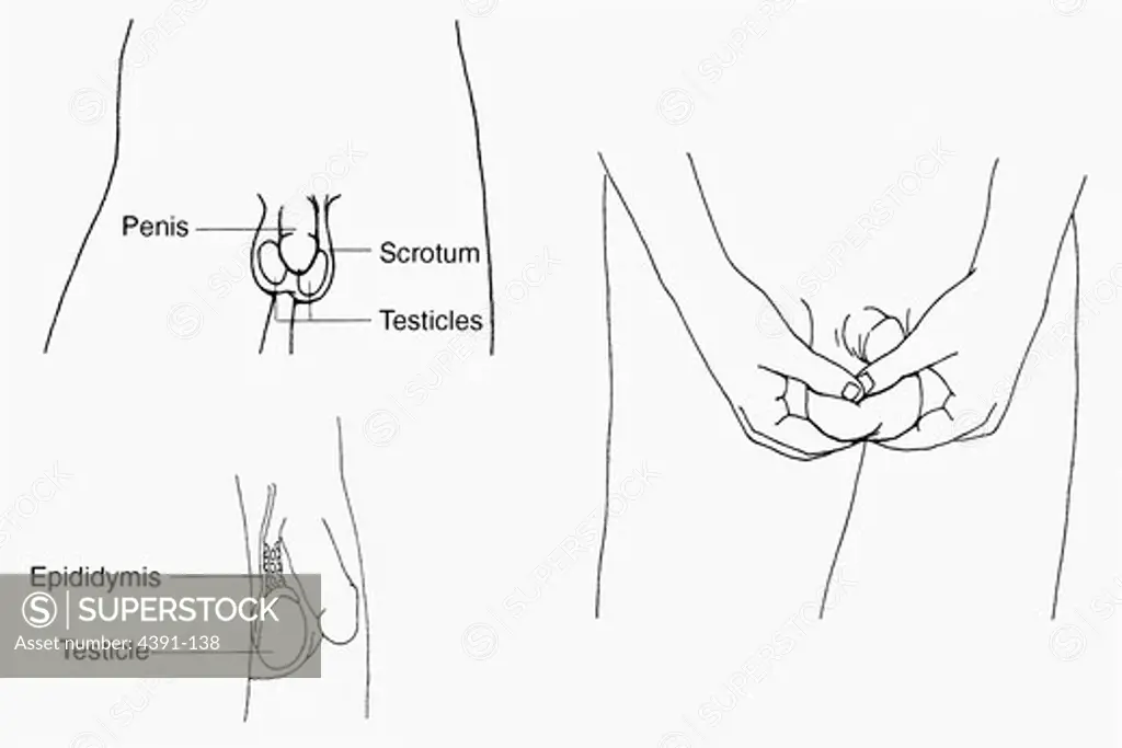 Three illustrations from 'What You Need to Know About Testicular Cancer:' 1)a diagram of the abdominal-pelvic area, listing the penis, scrotum, testicles; 2) a diagram of the self examination of the testicles; 3) a side view of the penis, testicles and epididymis.