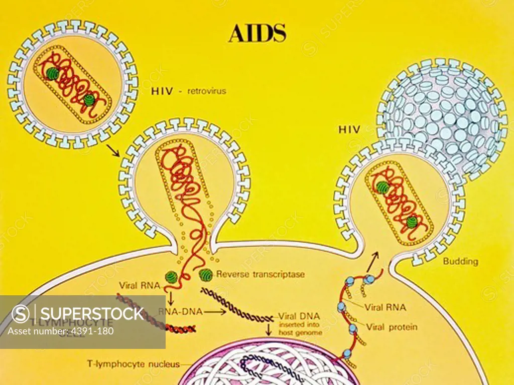 The human immunodeficiency virus (HIV-I) enters the T-lymphocyte where the virus loses its outer envelop, releasing its RNA and its reverse transcriptase. The reverse transcriptase builds a complimentary DNA strand from the viral RNA template. The DNA helix is inserted into the host genome. When this is transcribed by the infected cell, the new viral RNA and proteins are produced to form new viruses that then bud from the cell membrane, thus completing the life cycle of the virus. Illustration b
