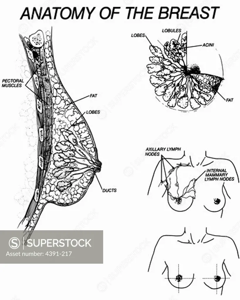 A diagram of the human female breast, including a cutaway, and subcutaneous details.