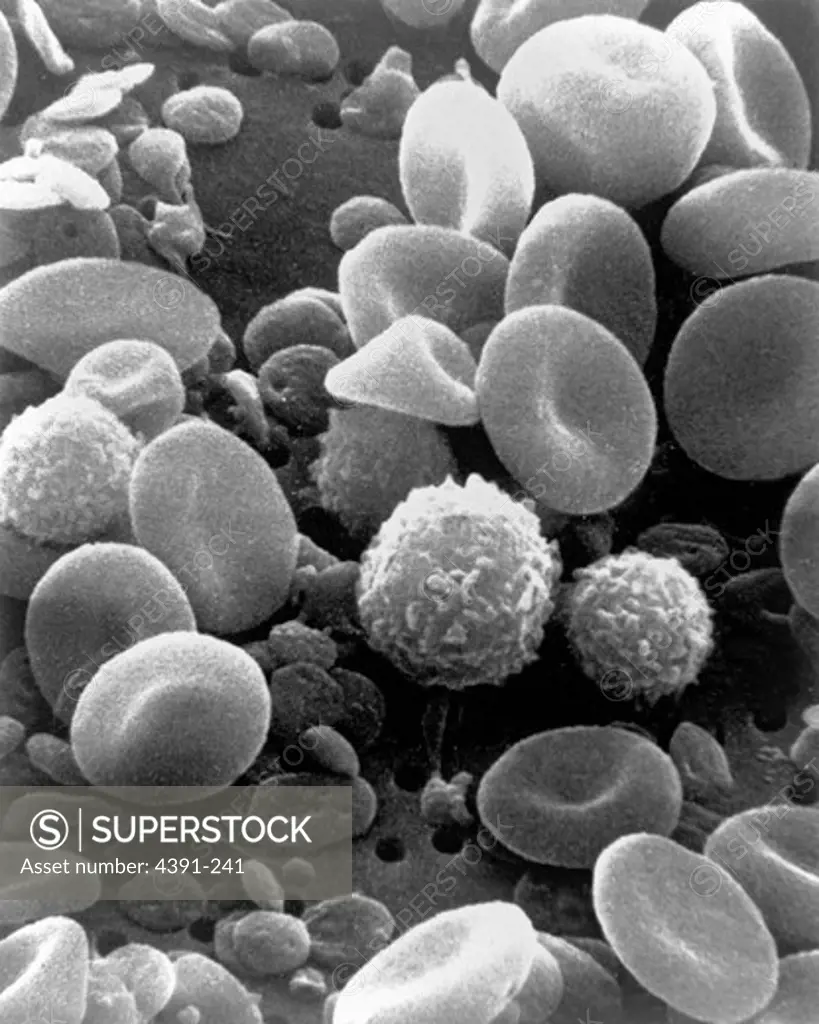 A scanning electron microsope's view of blood cells. The round non-nucleated doughnut shaped cells are red blood cells, which transport oxygen and remove carbon dioxide. The spherical cells with a rough texture are white blood cells, which produce antibodies and fight infection. The smallest peices are platelets, tiny cells needed for blood clotting. Photo by Bruce Wetzel and Harry Schaefer.