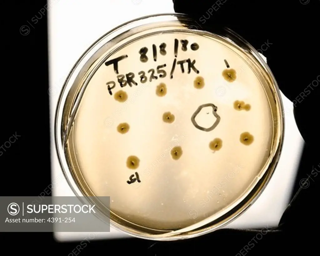 A technician holds a petri dish with culture medium. In this recombinant DNA technology, the thymidine kinase gene of herpes simplex virus is being cloned in bacteria. Those bacteria that have incorporated the gene are no longer resistant to the antibiotic tetracycline. By growing the bacteria on media that includes tetracycline, the colonies that don't grow are selected (circled in slide). These bacteria have incorporated the gene that is being studied.  Photo by Linda Bartlett.