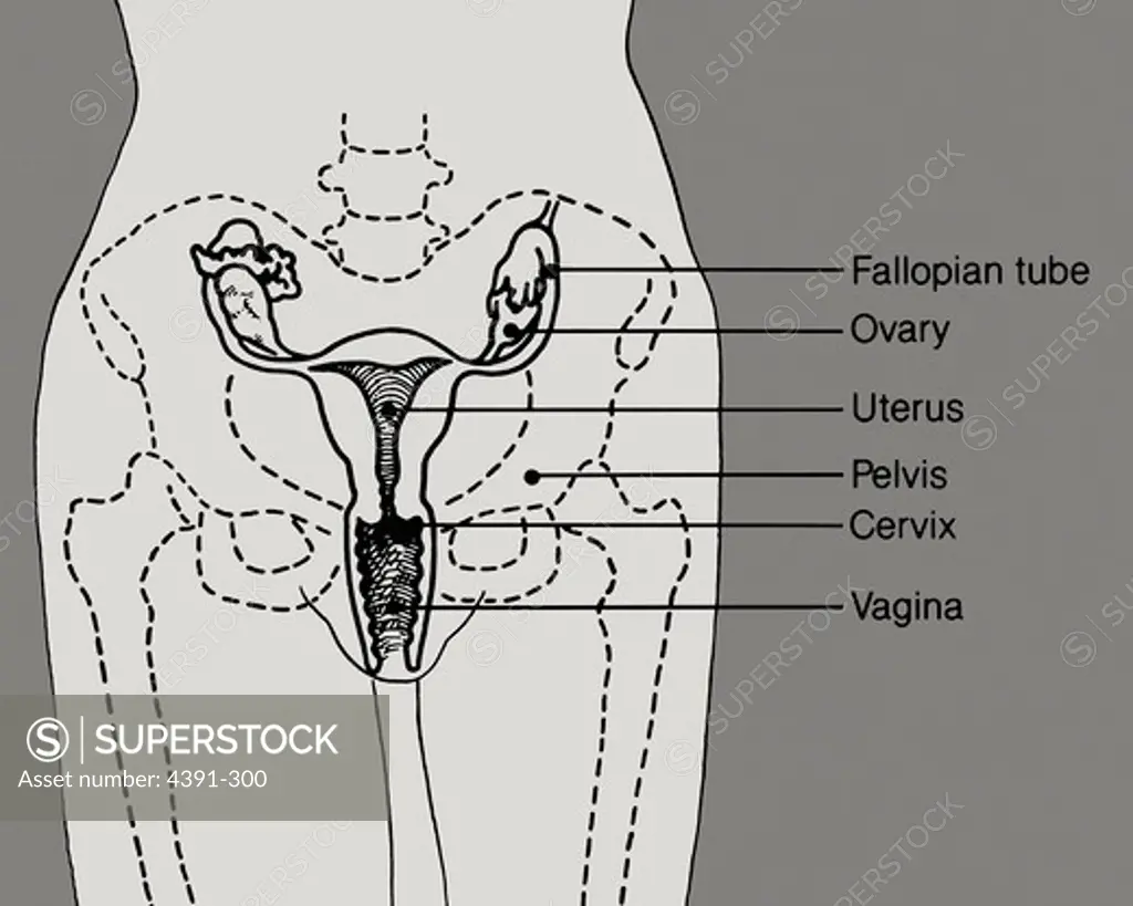 A line drawing of a woman's pelvic area showing the fallopian tubes, ovaries, uterus, cervix, and vagina.