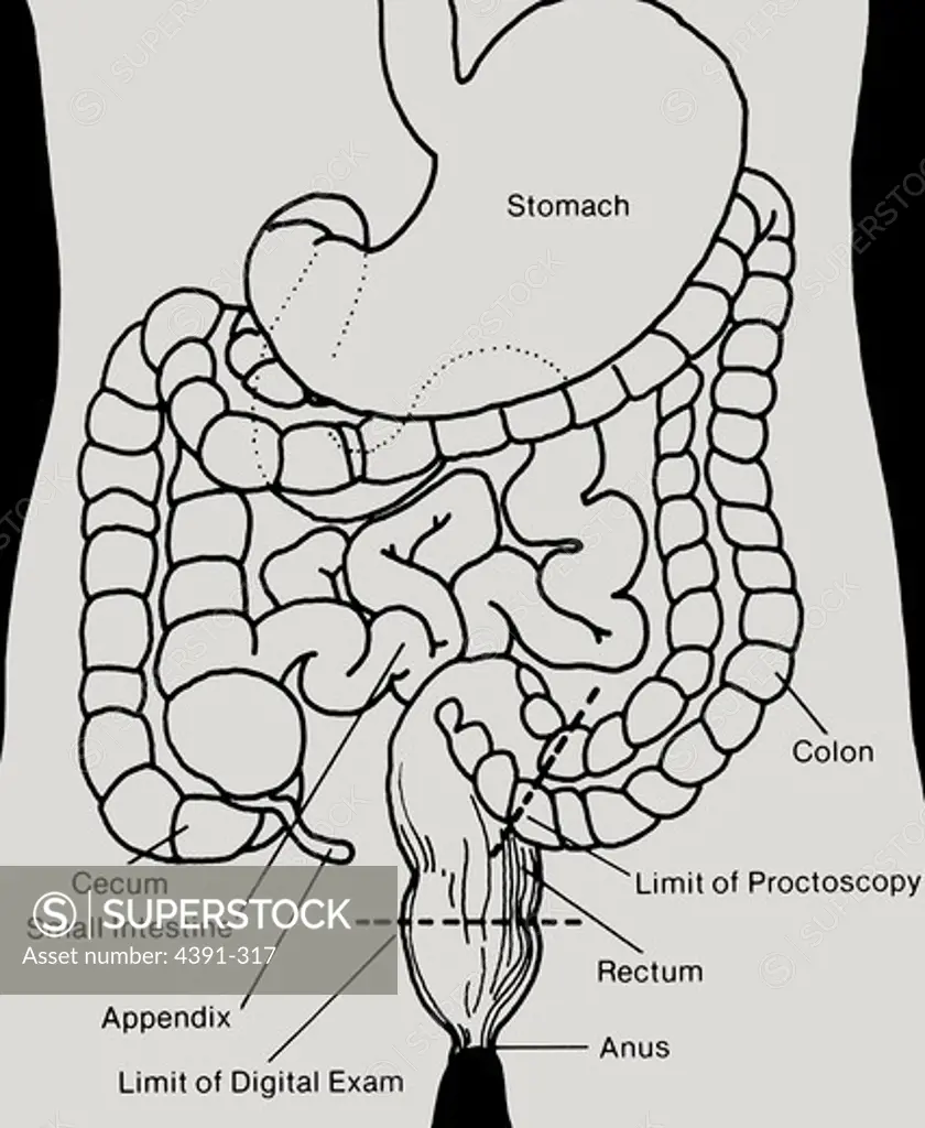A diagram of the lower digestive track includes the limit of a rectal finger exam and proctoscopy.