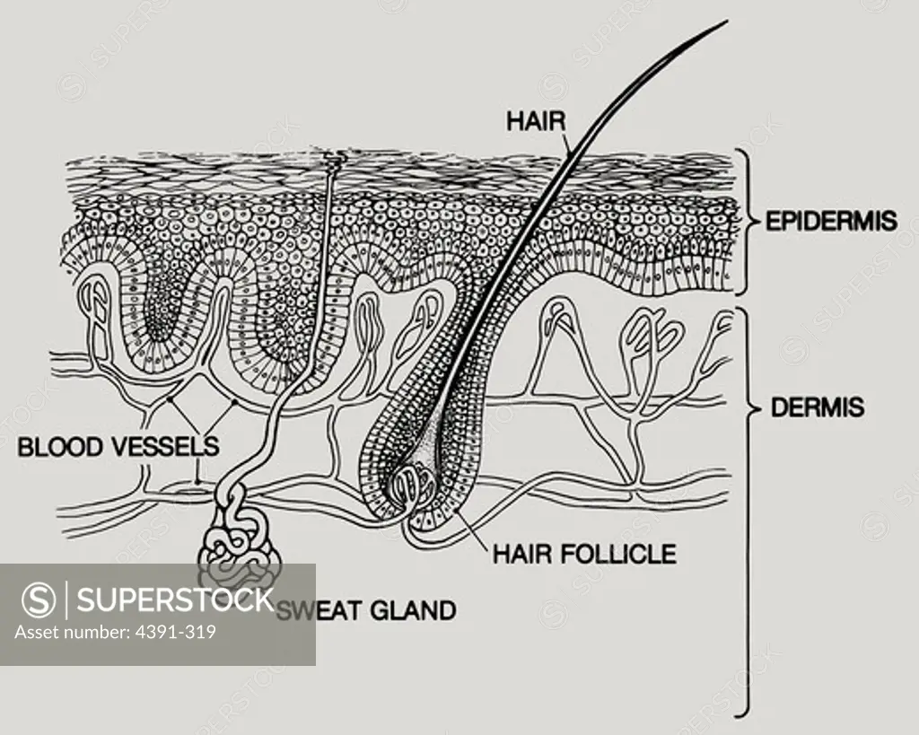 A diagram of layers of human skin. The two main layers are the epidermis and the dermis, and the two are crossed by sweat glands and hair; blood vessels run below the dead cells of the epidermis.
