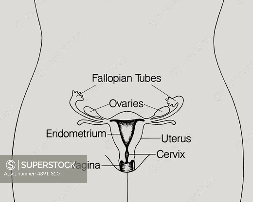 A line drawing of a woman's pelvic area showing the fallopian tubes, ovaries, uterus, endometrium, cervix, and vagina.