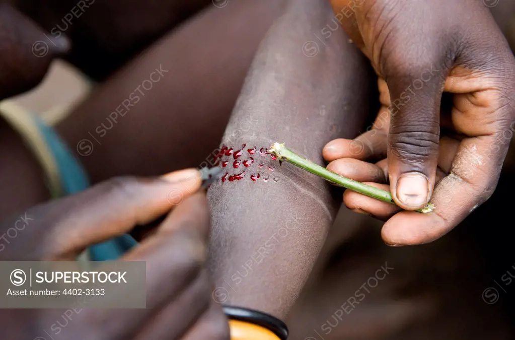 Using a thorn and razor blade, cuts are made for decorative scarring. Suri tribe, Omo Delta, Ethiopia