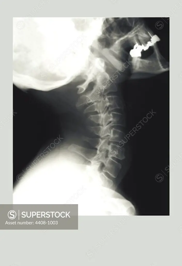 Skull and Neck, Medical - Xray / Radiology