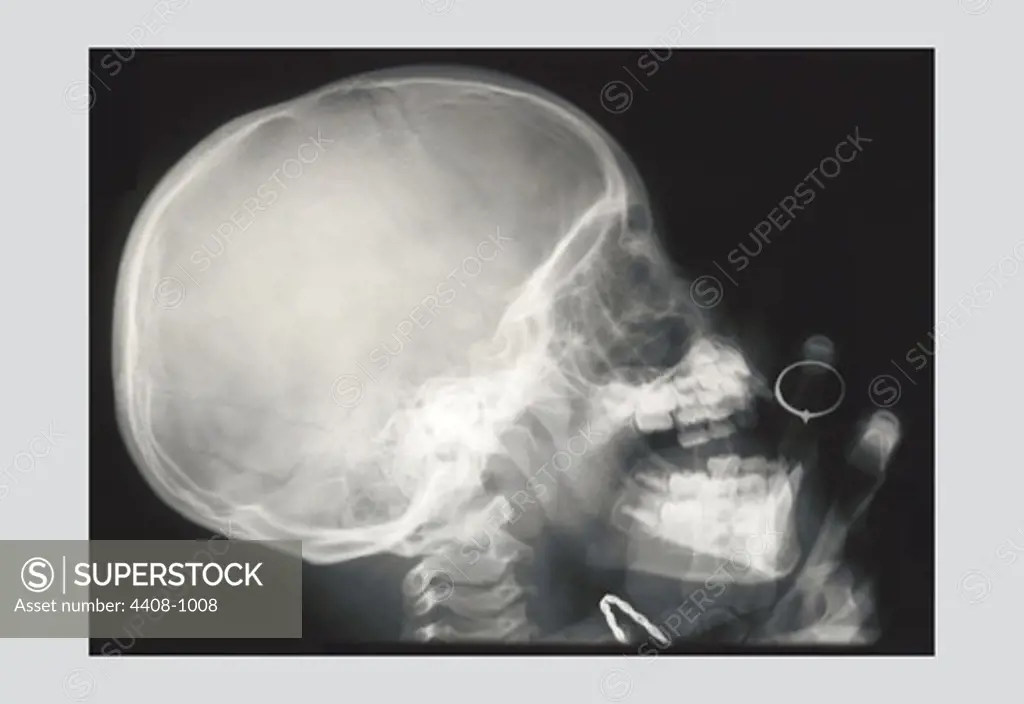 Skull and Hand, Medical - Xray / Radiology